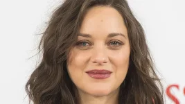 marion-cotillard-lip-injections.webp