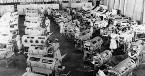 1950s_ironlungs_1.webp