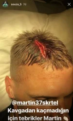 skrtel.webp