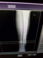 45609